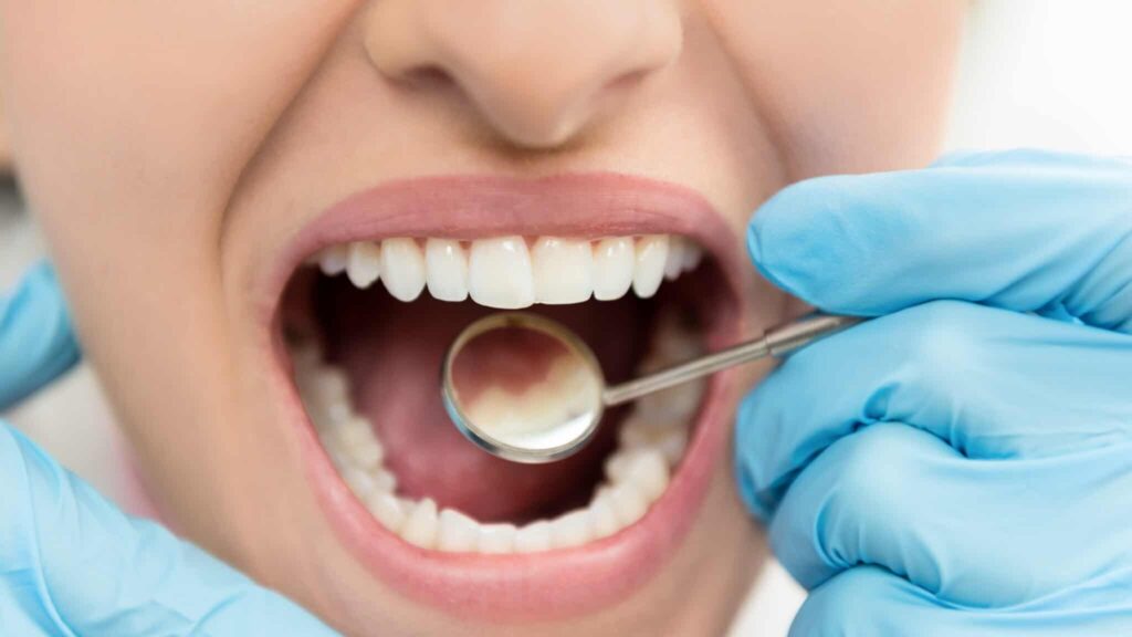Enamel