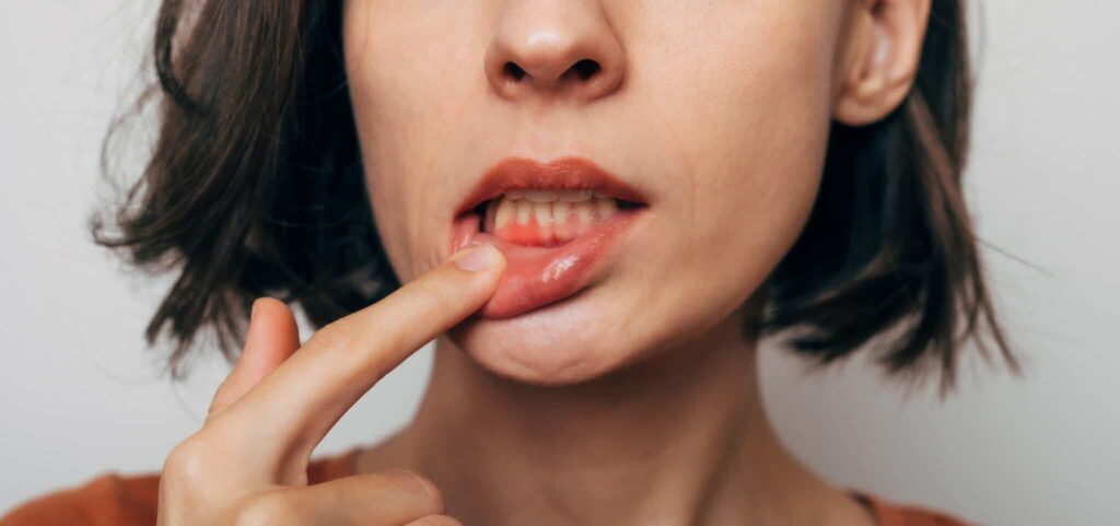 oral-gut axis